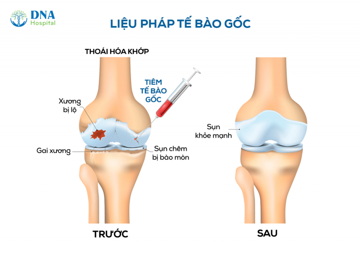 LIEU-PHAP-TE-BAO-GOC-CHO-THOAI-HOA-KHOP-GOI