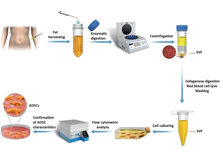 Quy trình điển hình để chuẩn bị ADSC từ mô mỡ của con người. SVF: phần mạch máu mô đệm [1].